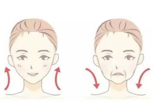 面部脂肪填充卡通对比图.jpg 面部脂肪填充卡通对比图.jpg