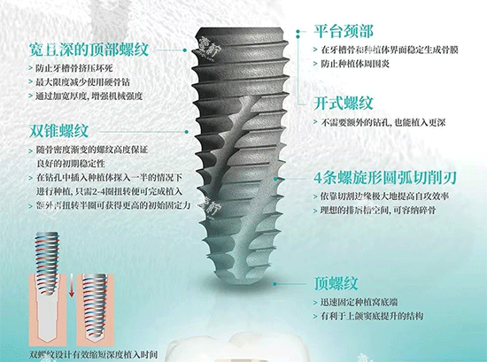 韩国伊诺种植牙植体照片.png